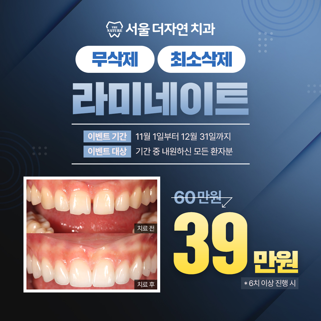 라미네이트 이벤트