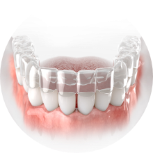 Begin Orthodontic Treatment
