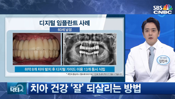 SBS 닥터Q