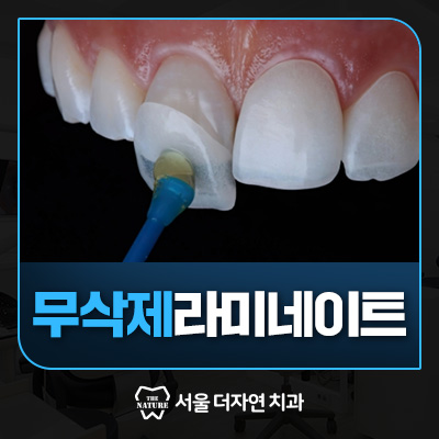 서비스04